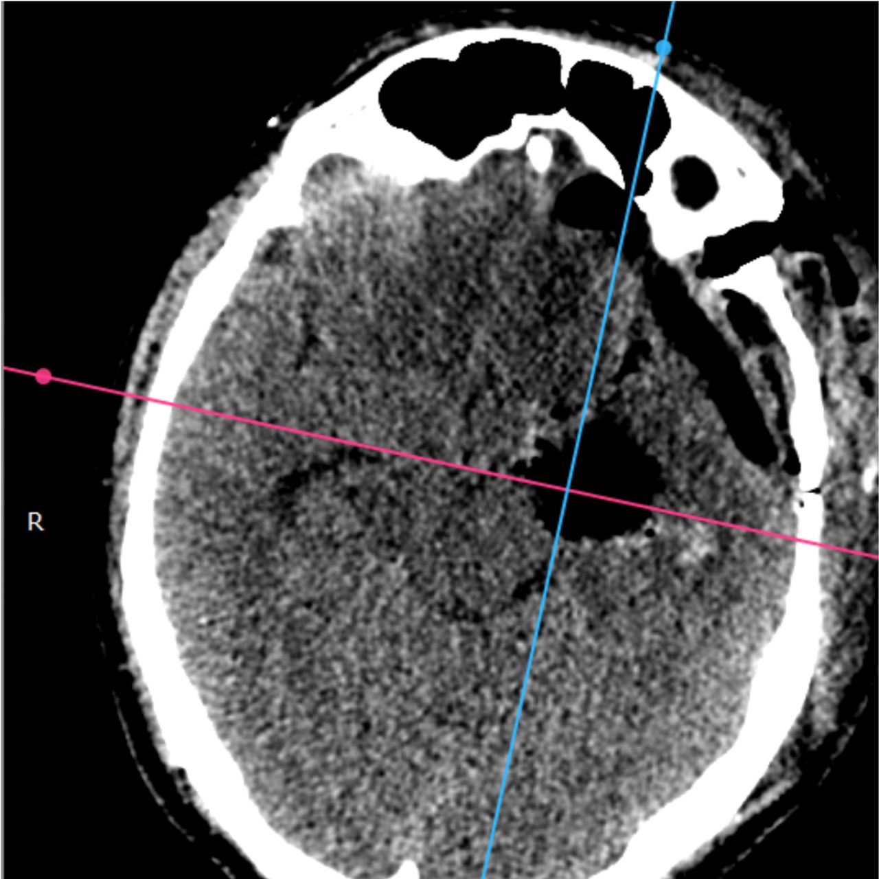 David Tafur Muñoz-1446