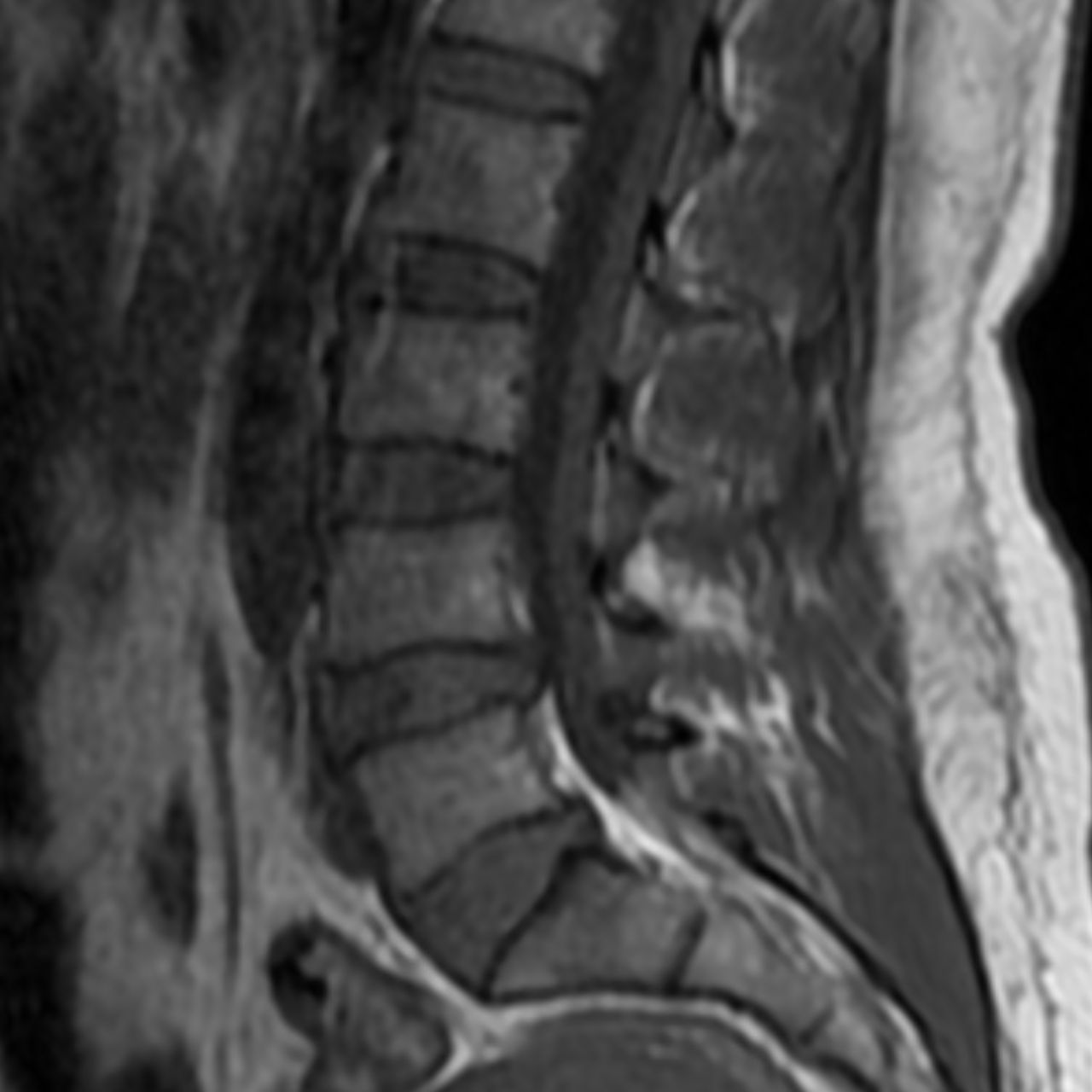 David Tafur Muñoz-1785