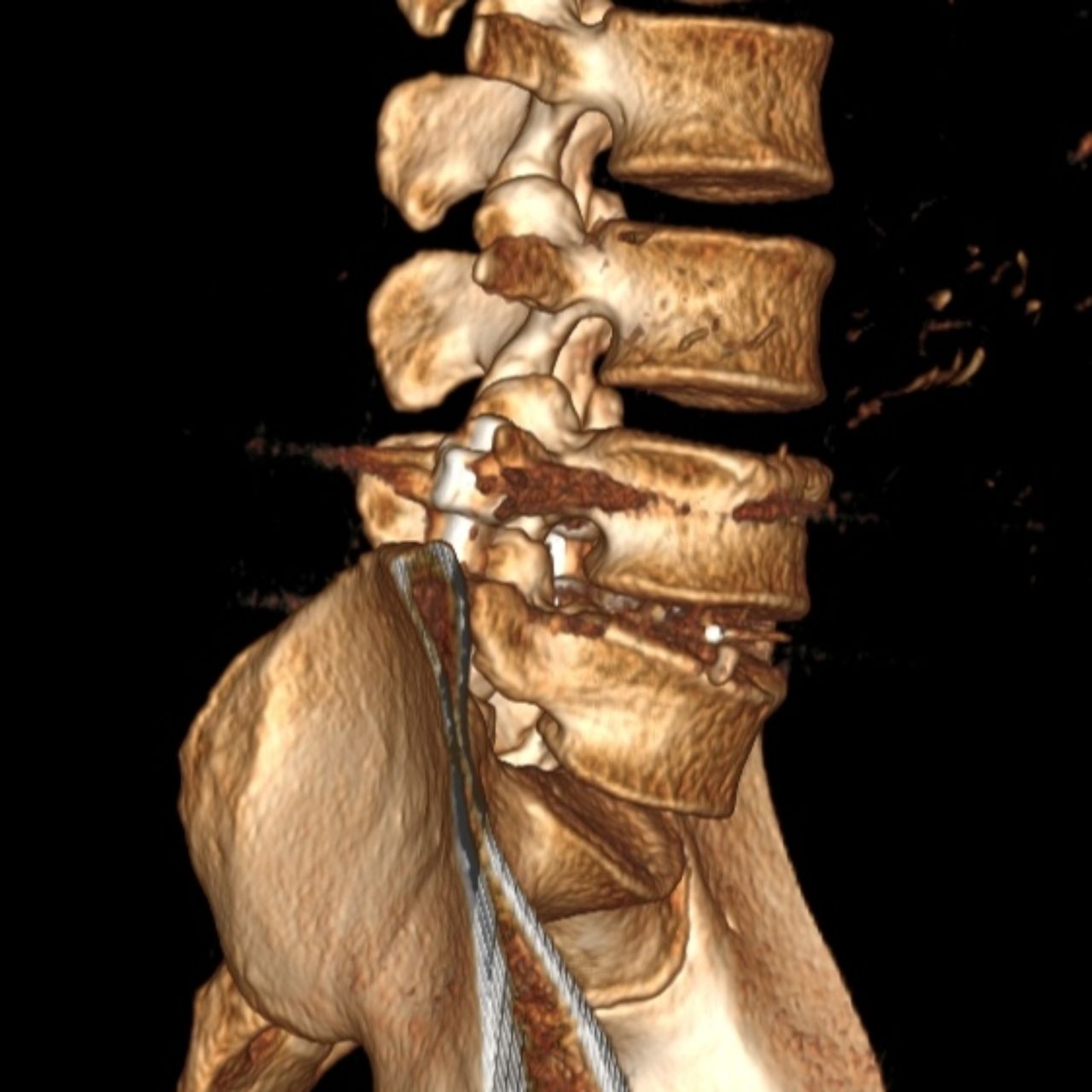 David Tafur Muñoz-1215