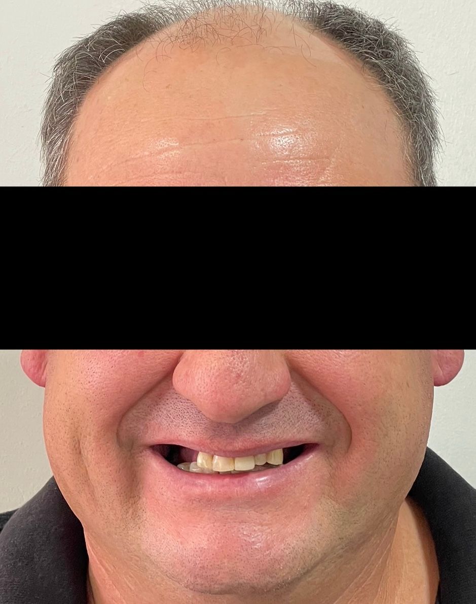 Luciano Varas Salinas-28