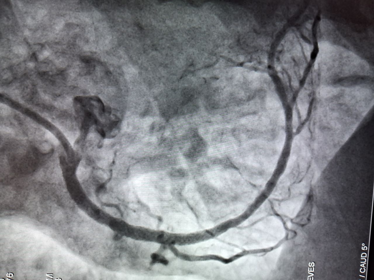 Leonardo Da Cruz Nunes-0