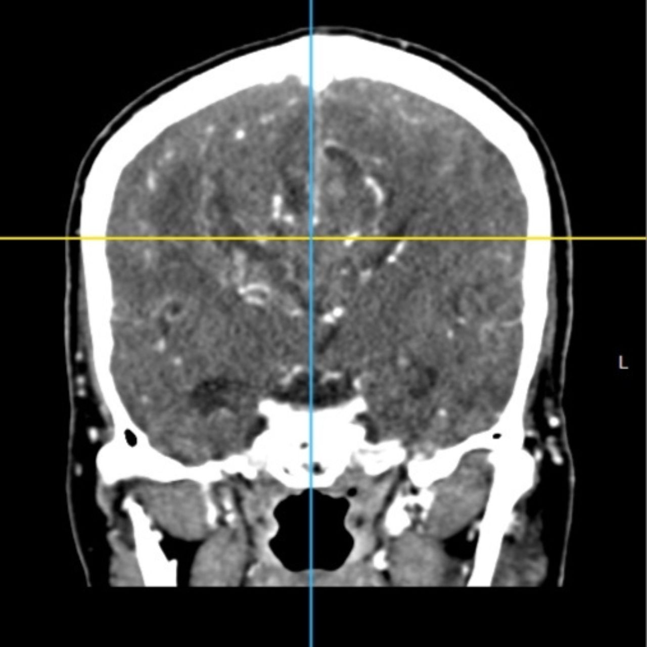 David Tafur Muñoz-2234
