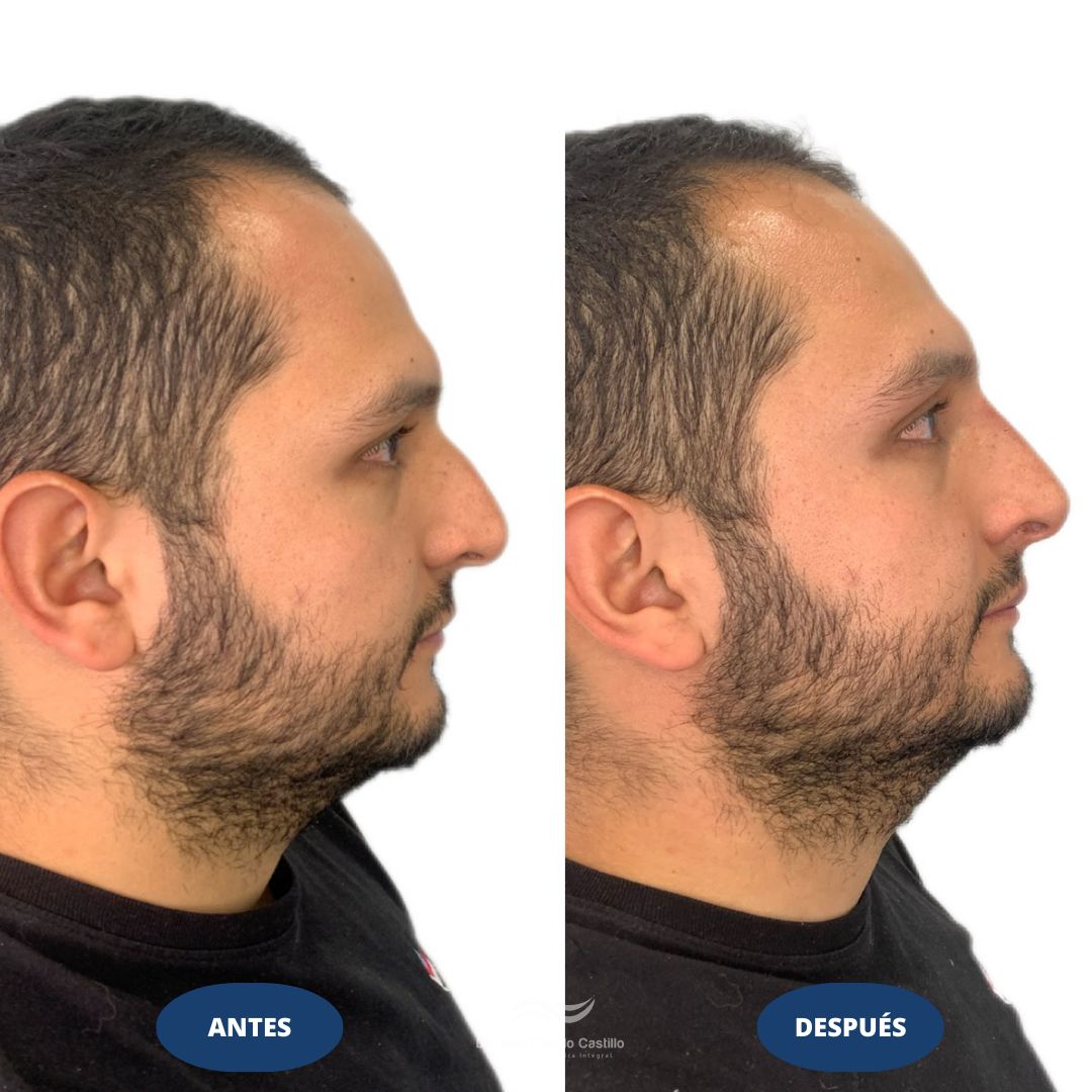 Juan Camilo Castillo-18