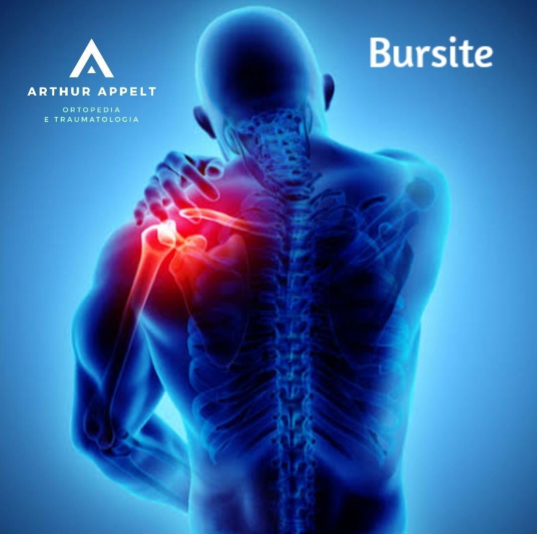 Arthur Lanna Appelt-0