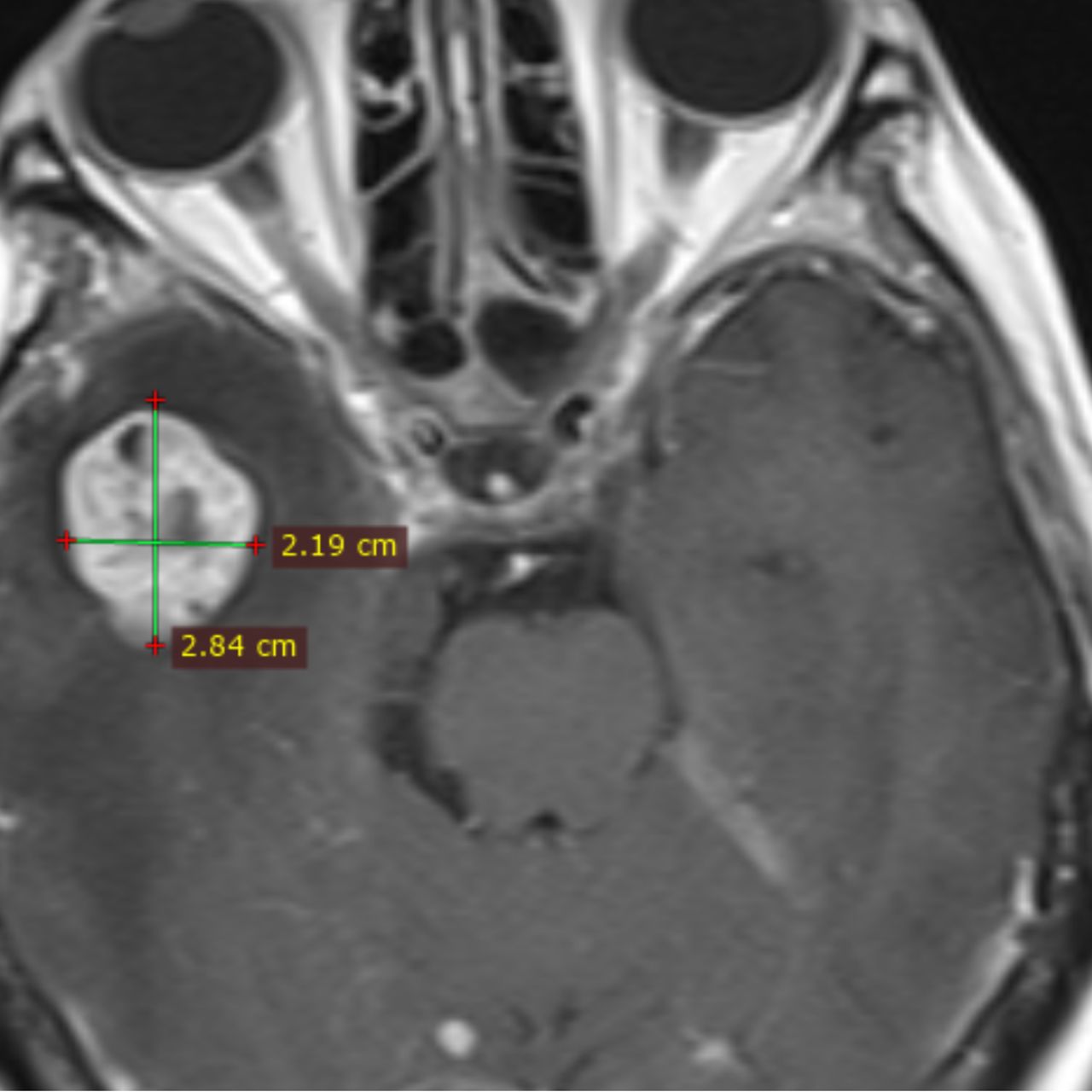 David Tafur Muñoz-1829