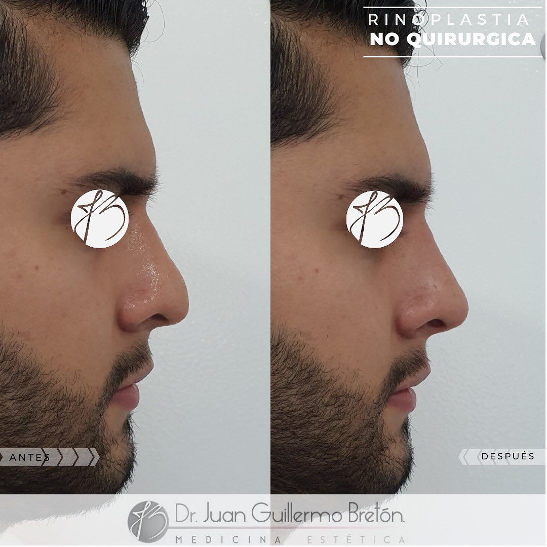 Juan Guillermo Bretón Franco-15