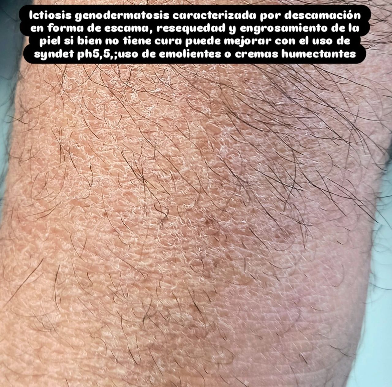 Marcos Ortiz Perez-13