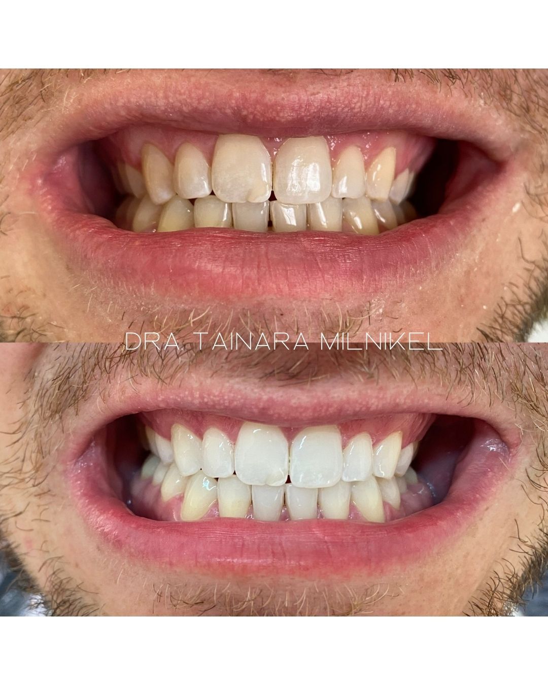 Tainara Rieger Milnikel-6