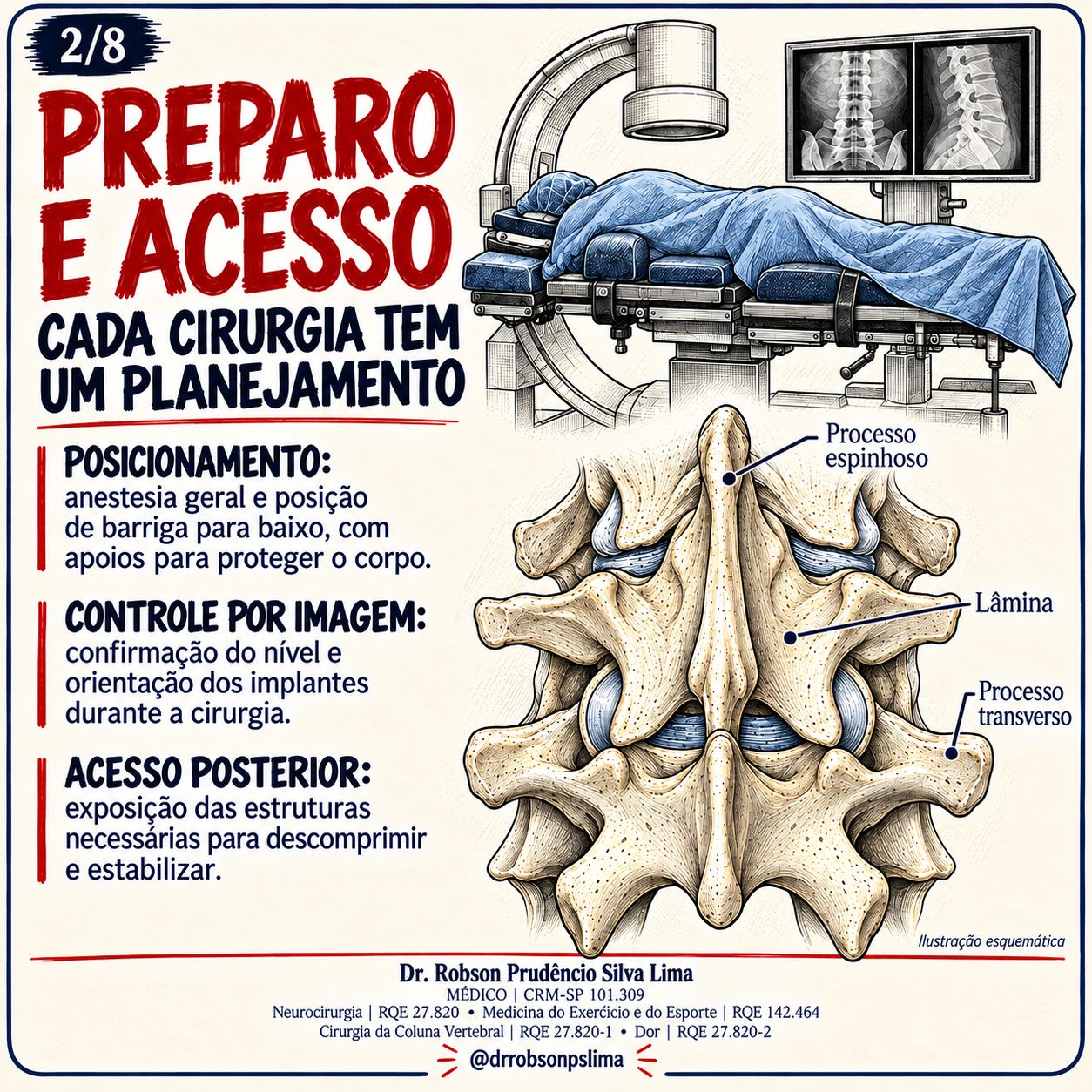 Robson Prudêncio Silva Lima-203