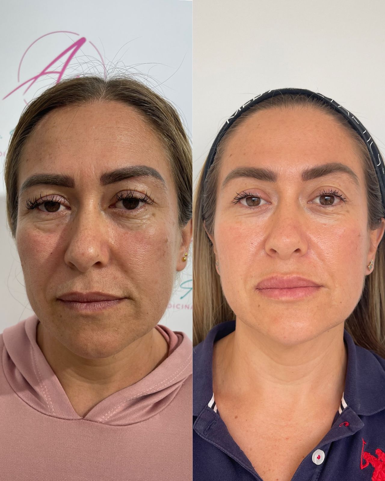 Alexandra Valderrama-4