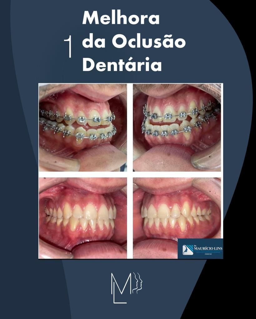 Mauricio Lins Moura-15