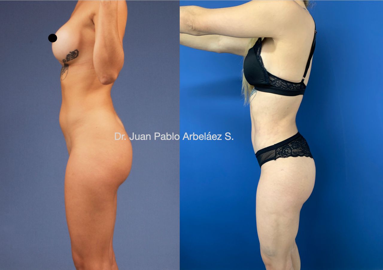 Juan Pablo Arbeláez Sierra-24