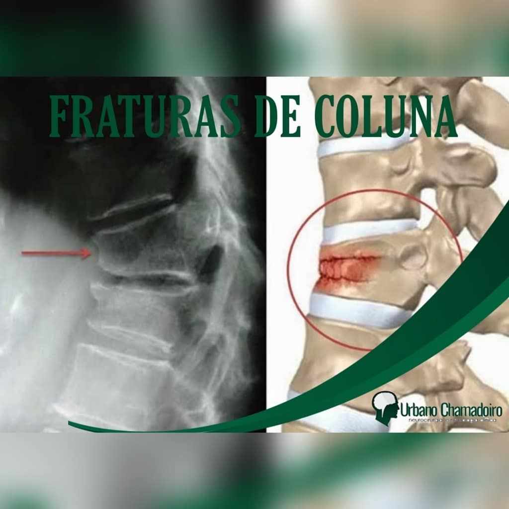 Urbano Chamadoiro-21