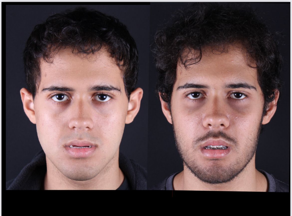 Frederico Carnevale-13