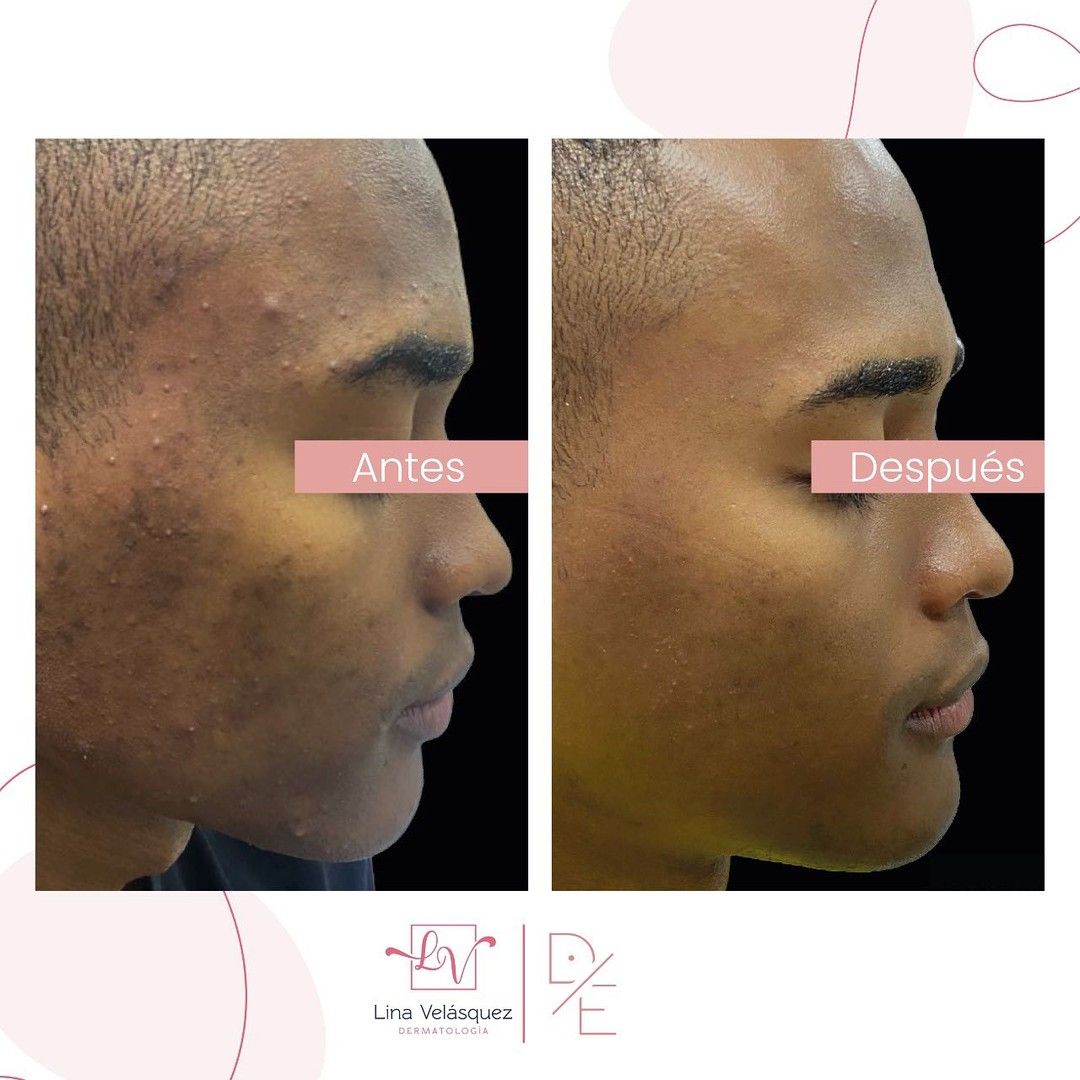 Lina Velásquez Tafur-16