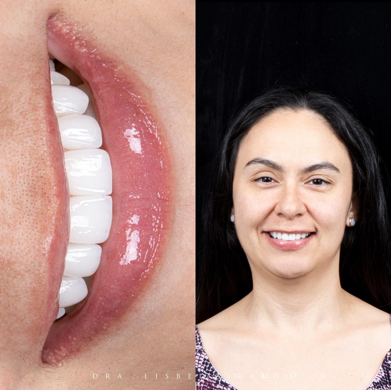 Lisbed Giraldo Olarte-43