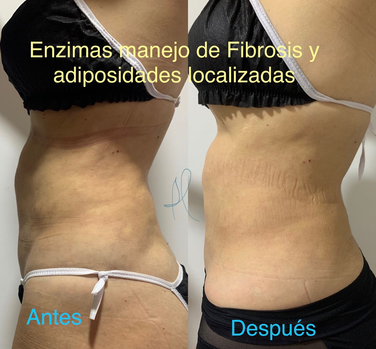 Maria Gisela Angel Losada-16