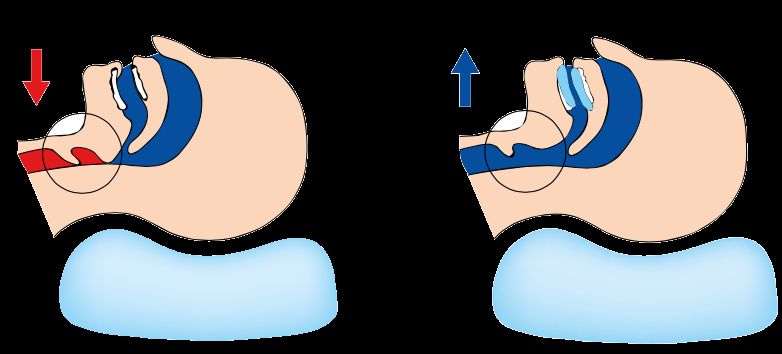 Aarón Núñez Osses-8