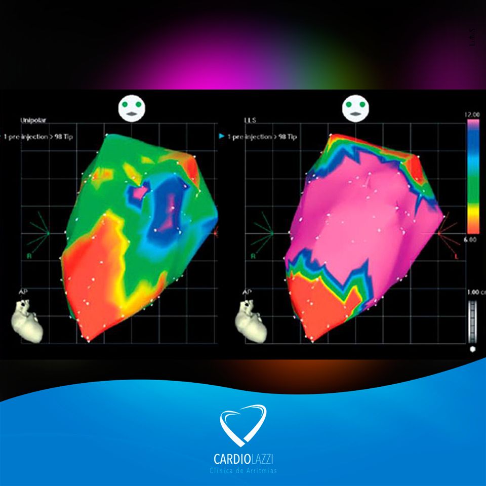Frederico Bartolazzi-18