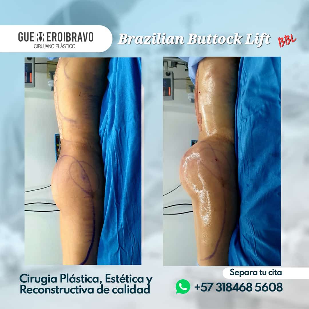 Camilo Guerrero Bravo-32