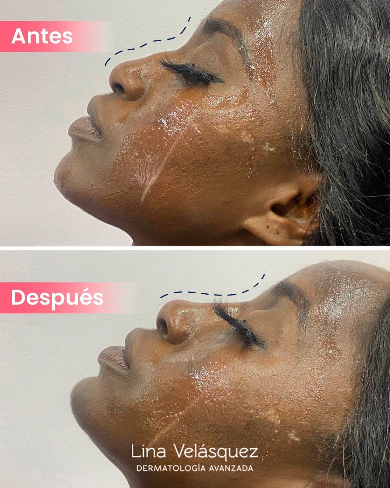 Lina Velásquez Tafur-5