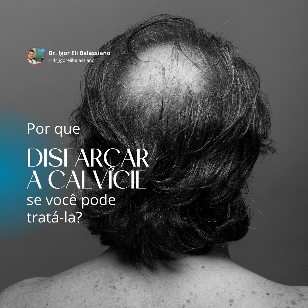 Igor Eli Balassiano-4