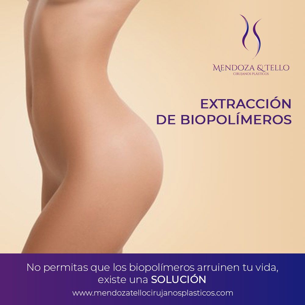 Alexander Mendoza-53