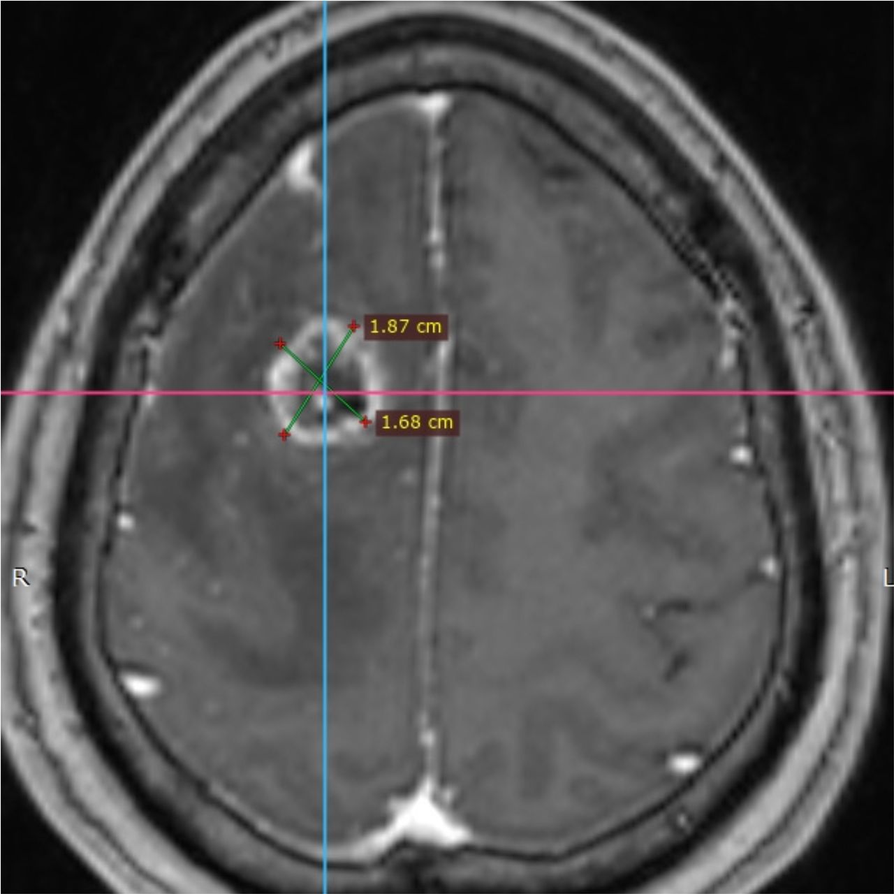 David Tafur Muñoz-1537