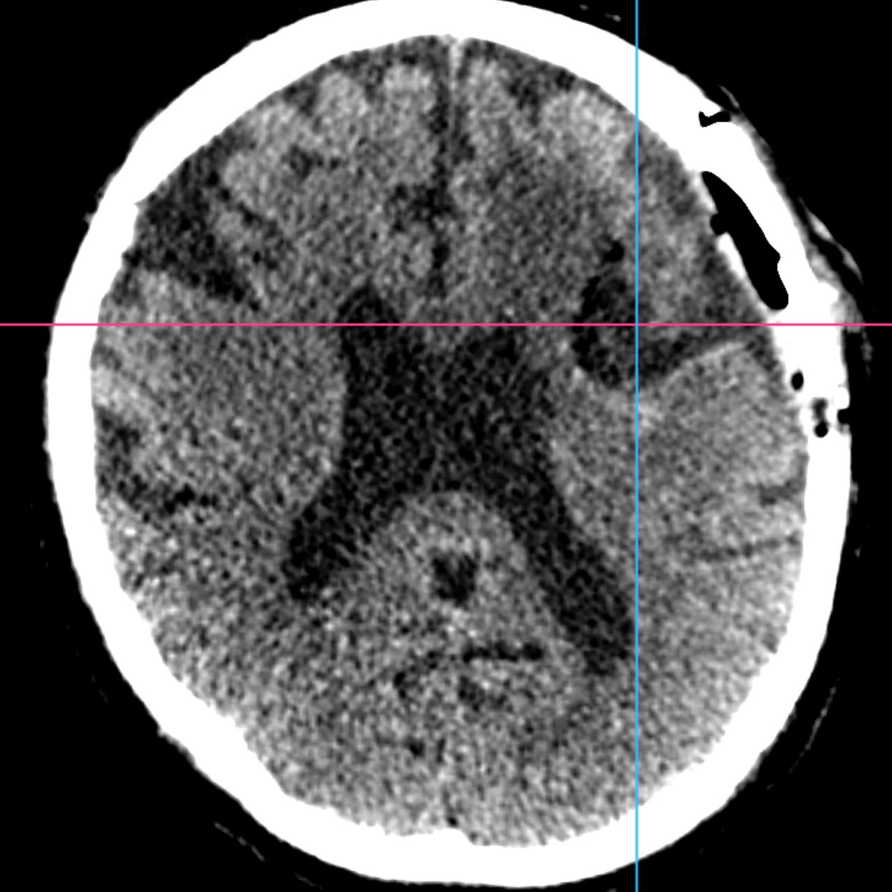 David Tafur Muñoz-1490