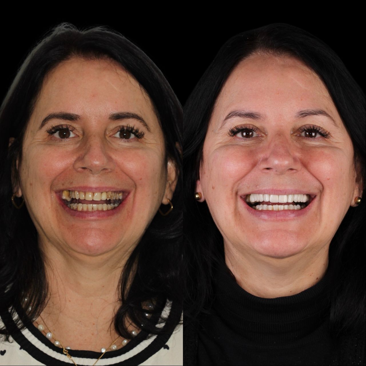 Caroline Benedeti-32