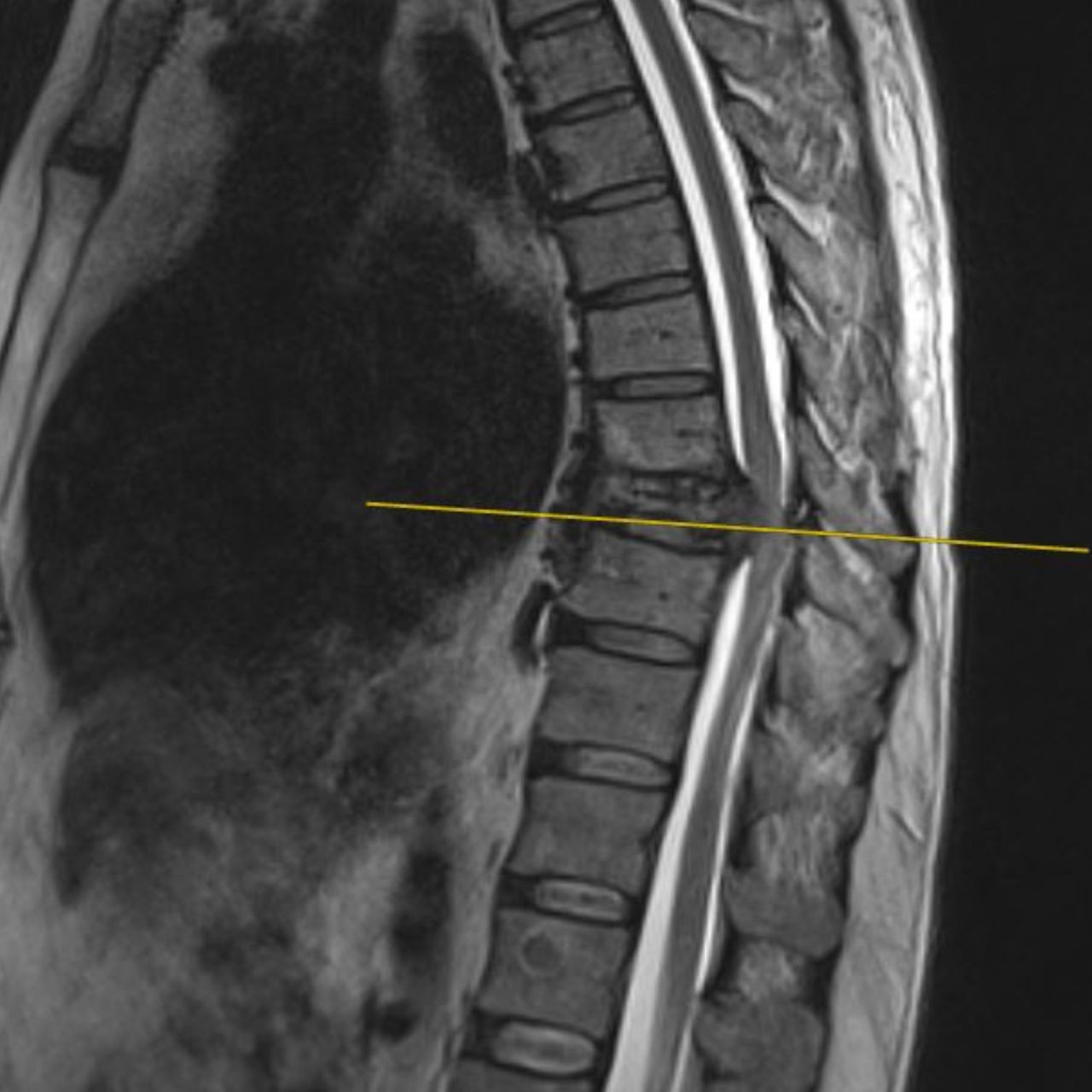 David Tafur Muñoz-1519