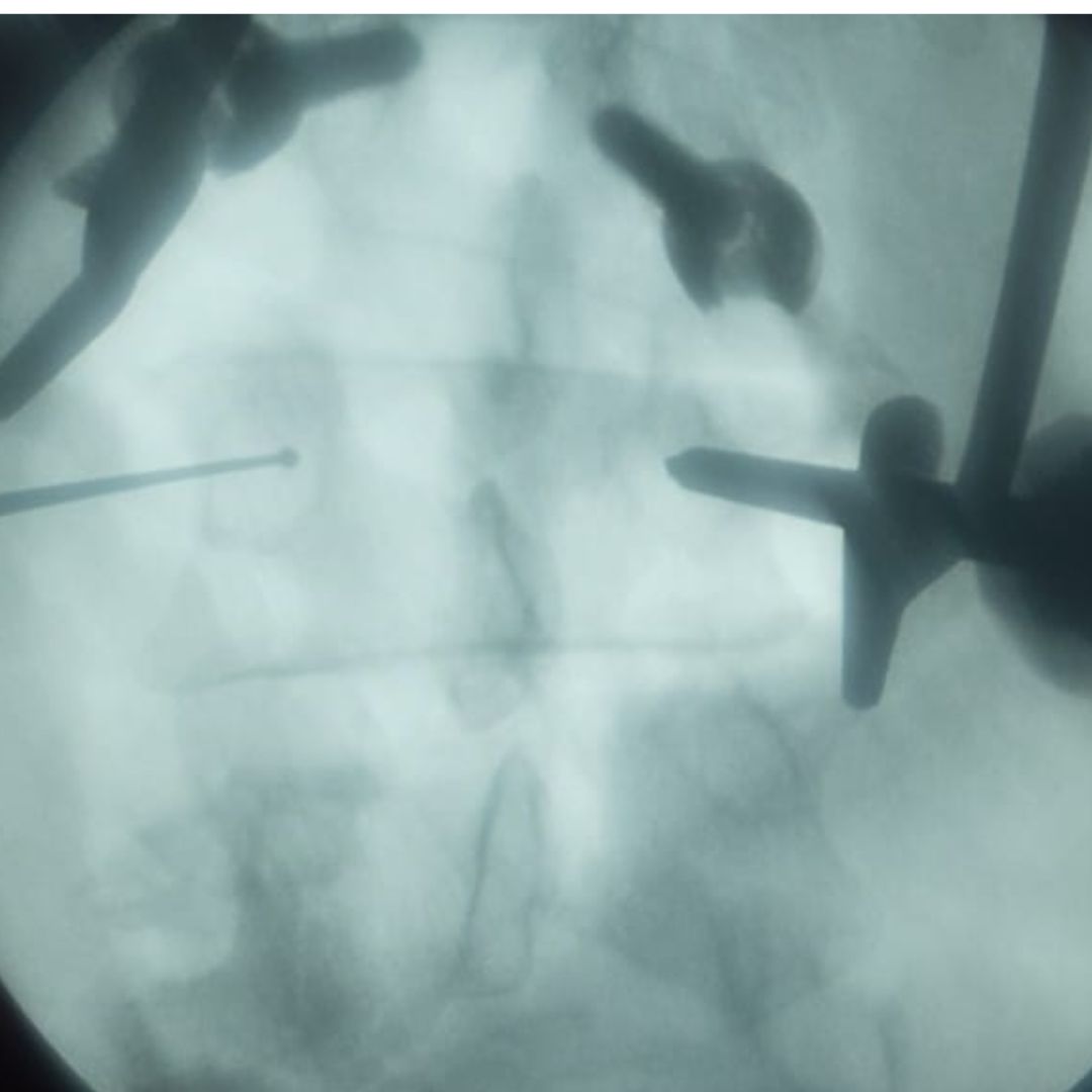 David Tafur Muñoz-2326