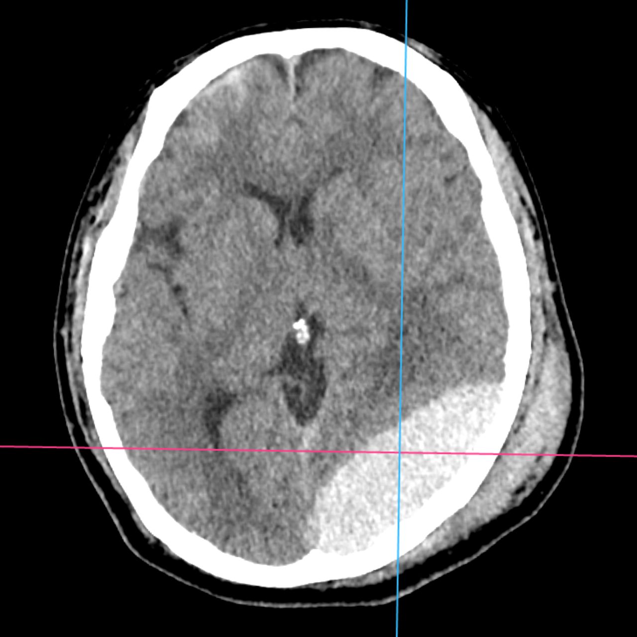 David Tafur Muñoz-1720