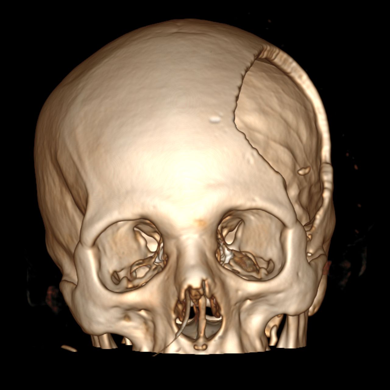 David Tafur Muñoz-1183