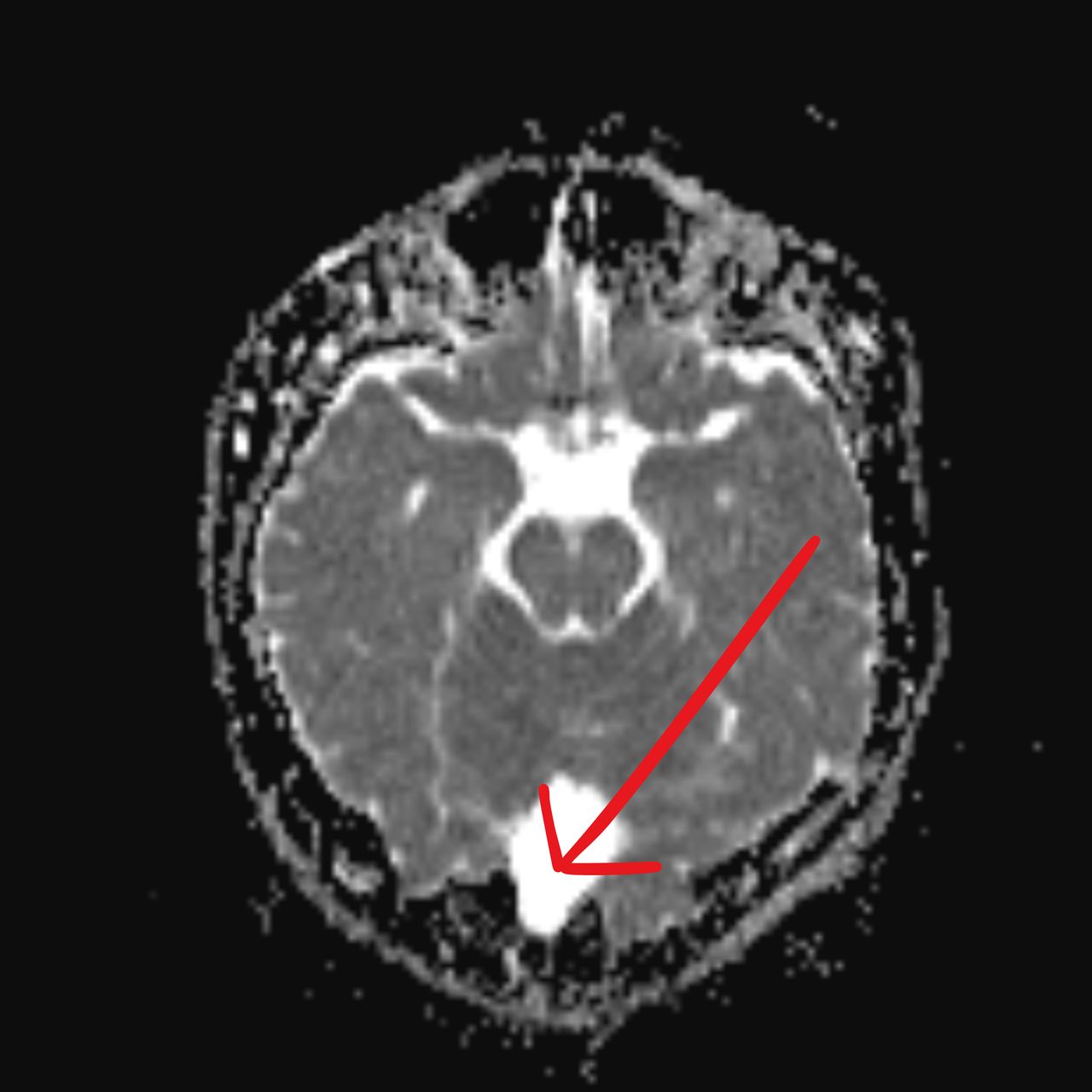 David Tafur Muñoz-2169
