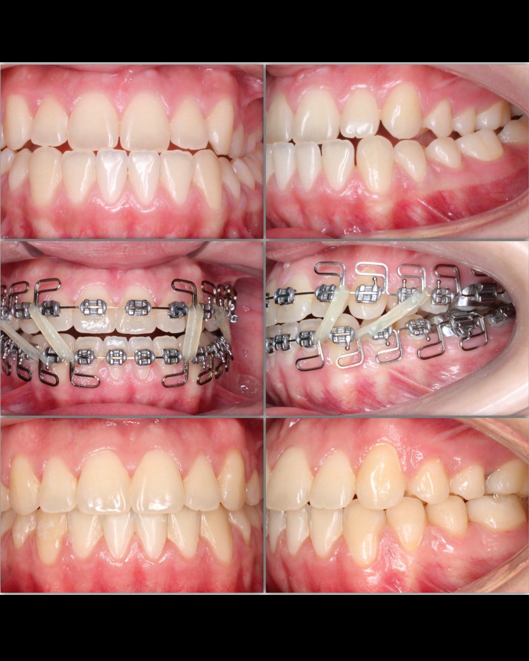 Carlos Manterola Marchant-10