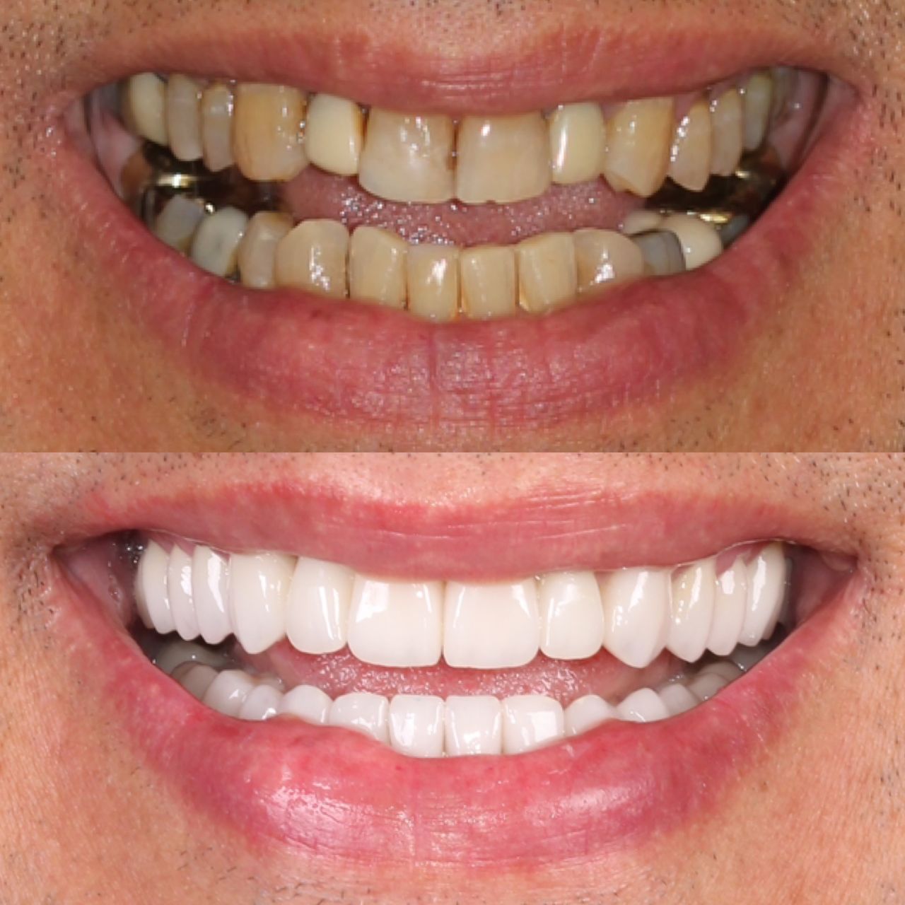 Caroline Benedeti-14