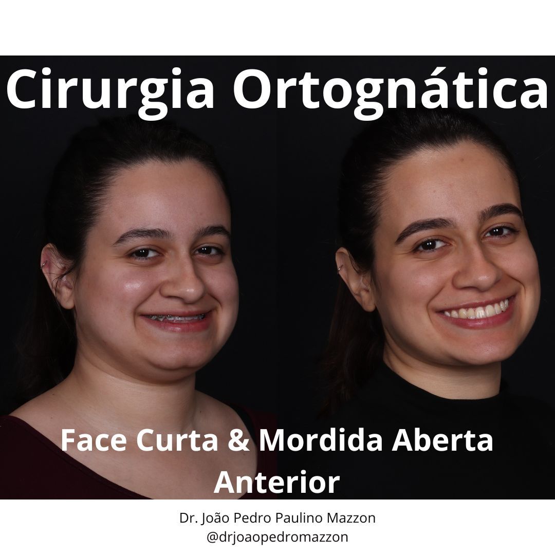 João Pedro Paulino Mazzon-60