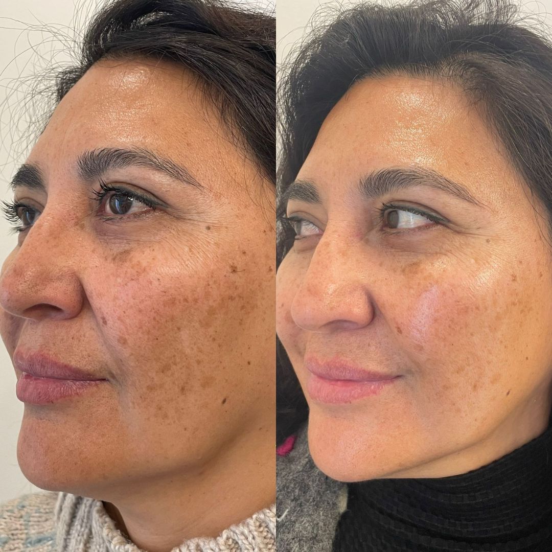 Scarlett Bartsch Ferrada-31