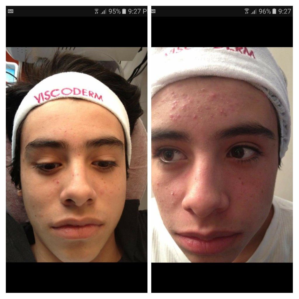 Julián Guerrero Almeida-34