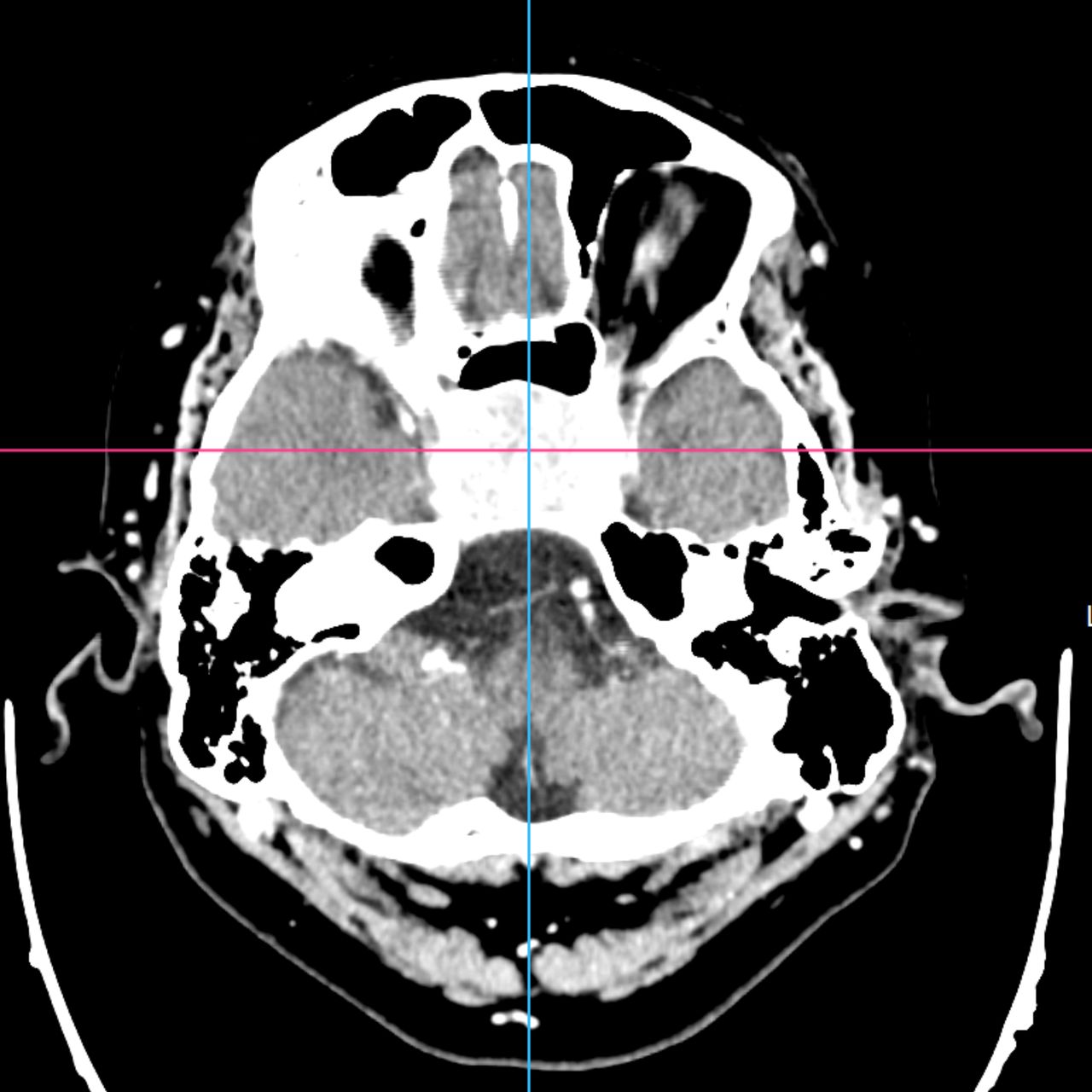 David Tafur Muñoz-2005