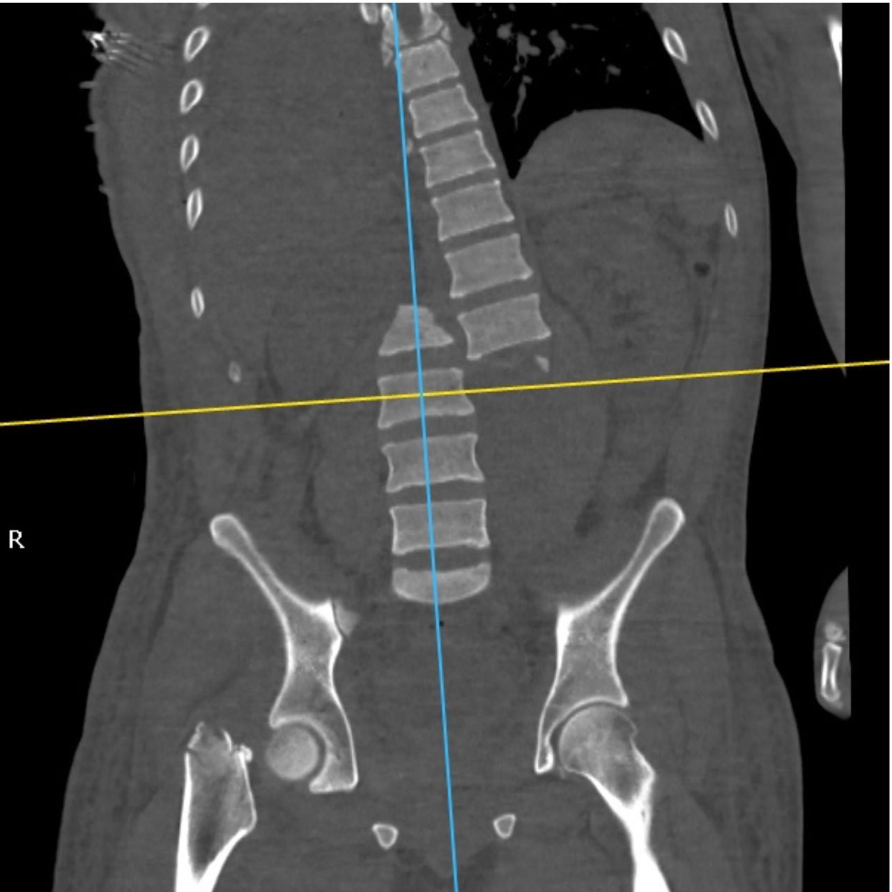 David Tafur Muñoz-1529