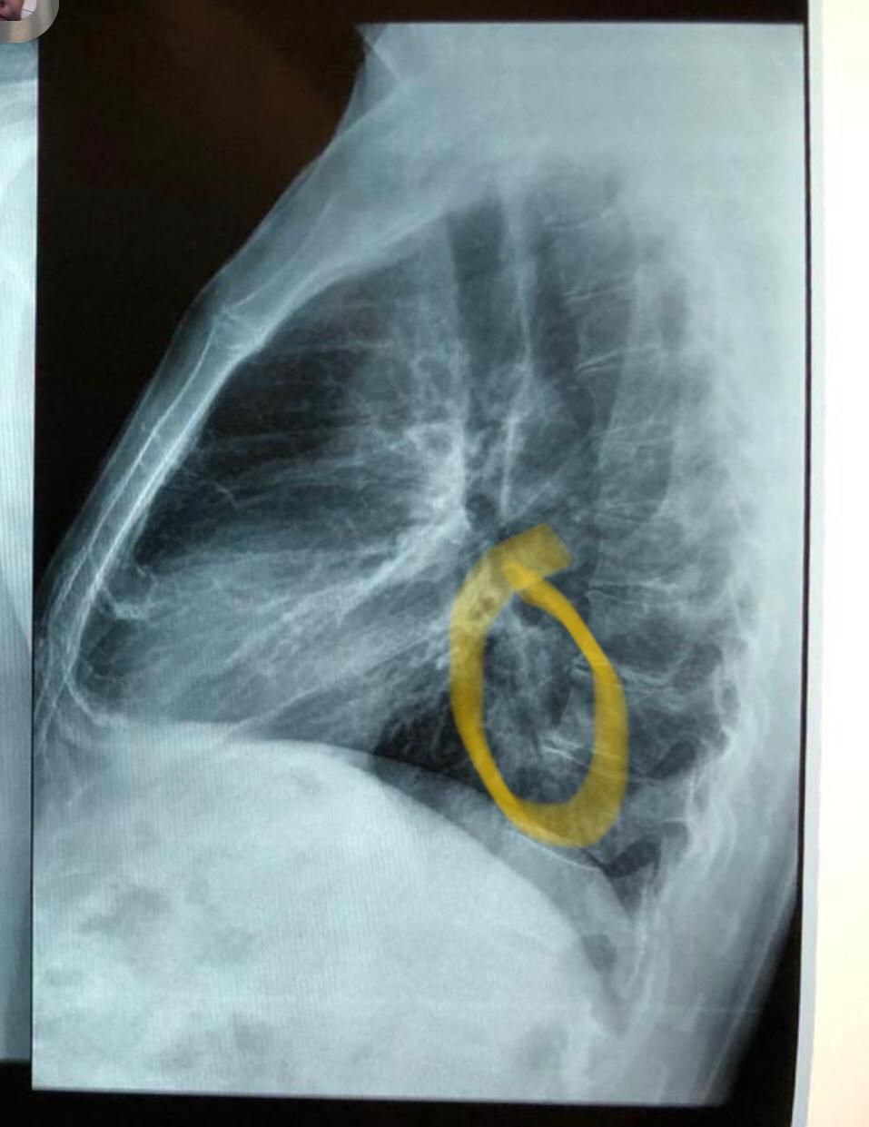 Larissa Cau Carlet-16