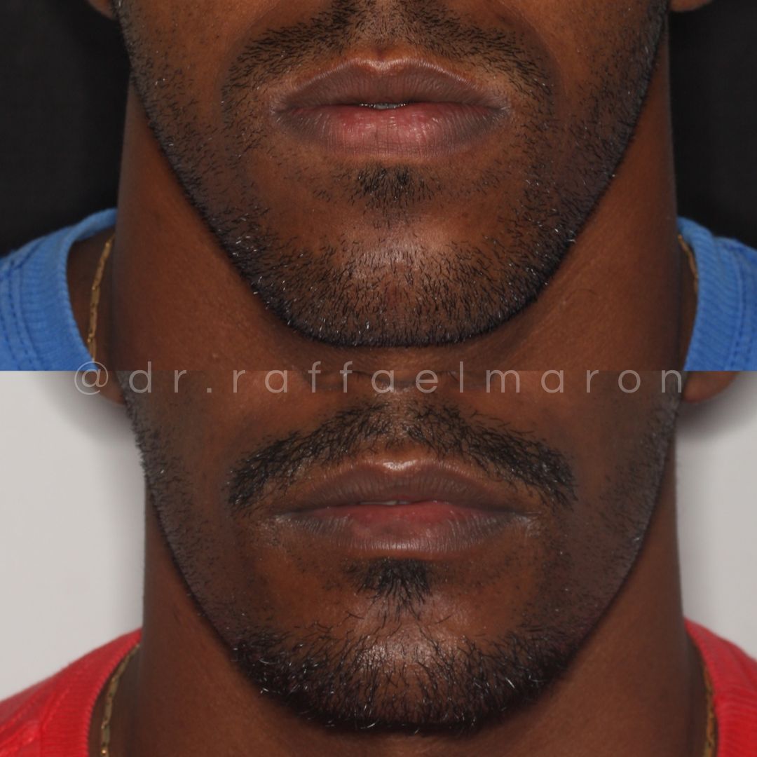 Raffael Maron Vieira De Noronha-23