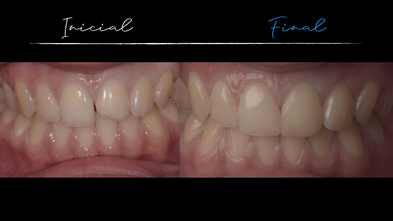 Matías Soto Parra-7