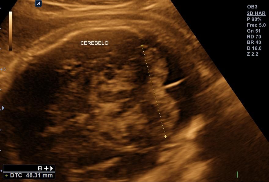 Benjamín Villarroel Castillo-11