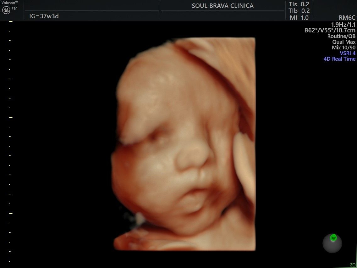 Charles Schwantz De Lima-13