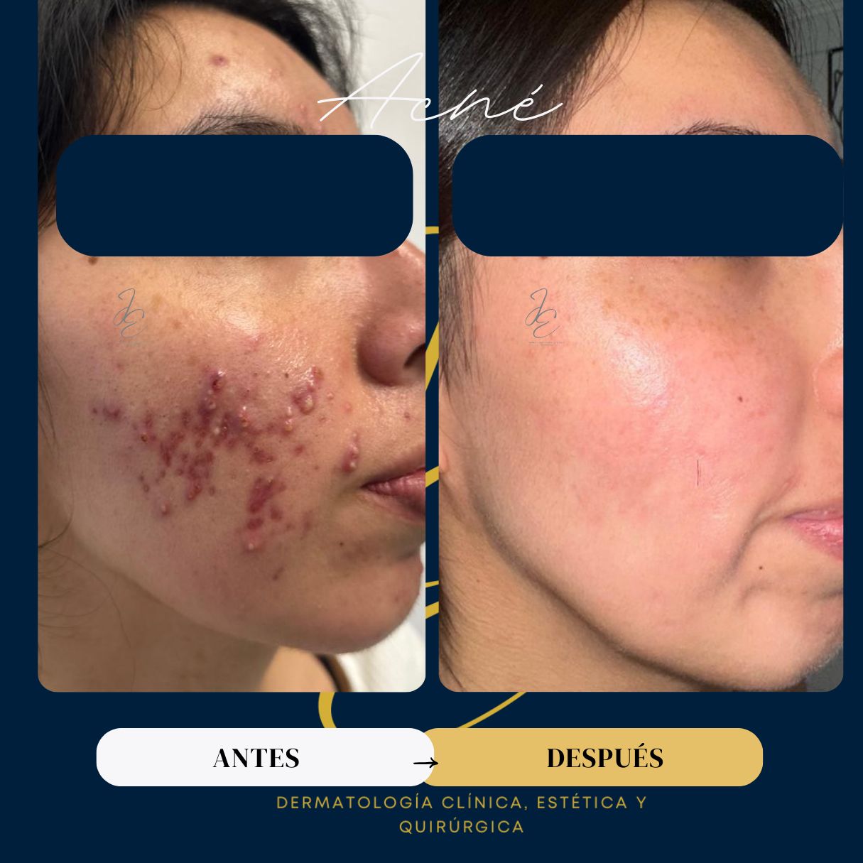 Jeanny Epieyu Diaz-16