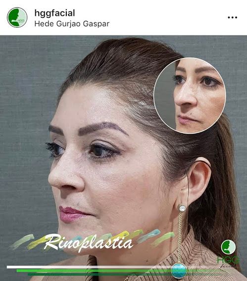 Hede Gurjão Gaspar-2