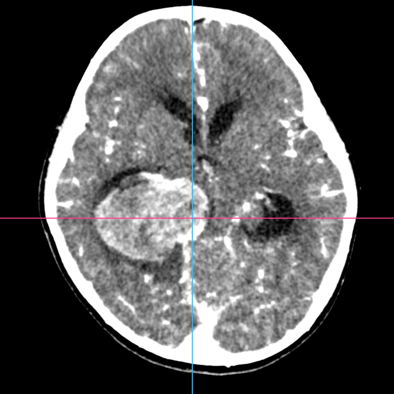 David Tafur Muñoz-1730